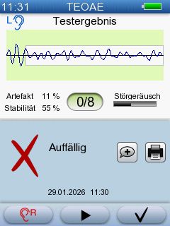 AccuScreen TEOAE REFER