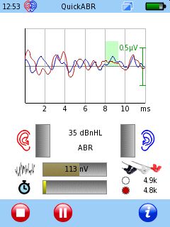 Sentiero Advanced Monaural vs Binaural