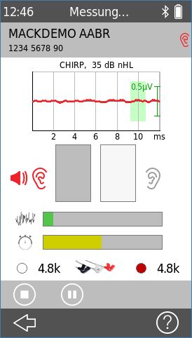QScreen - AABR-Messung (monaural)