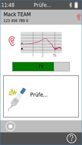 QScreen - OAE-Sonde Kalibrierung