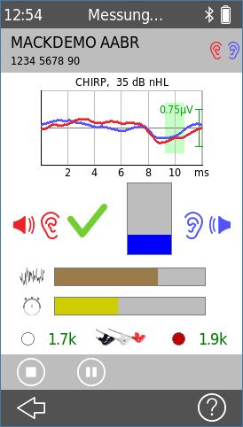 QScreen (UNHS) AABR Erweiterung